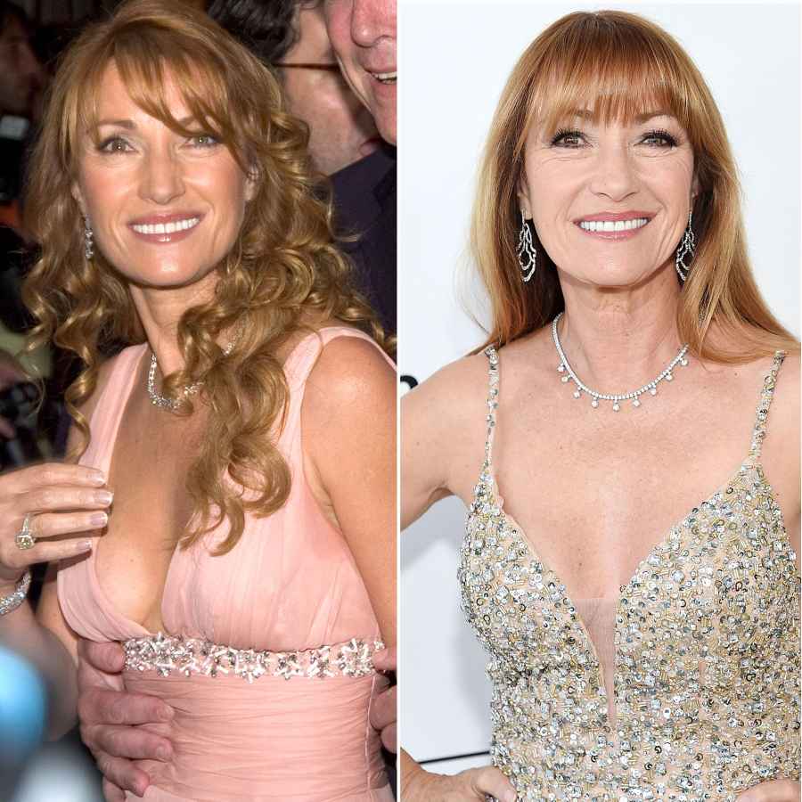 plastic surgery celebs before after