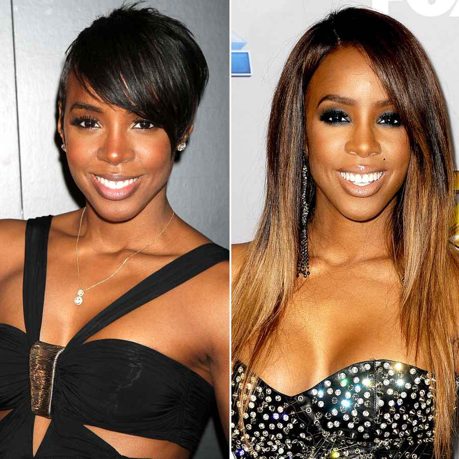 plastic surgery celebs before after