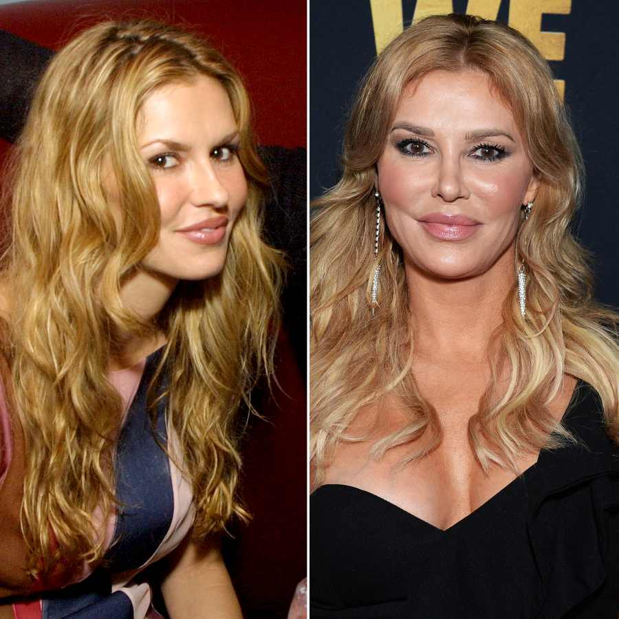 Brandi Glanville before and after plastic surgery