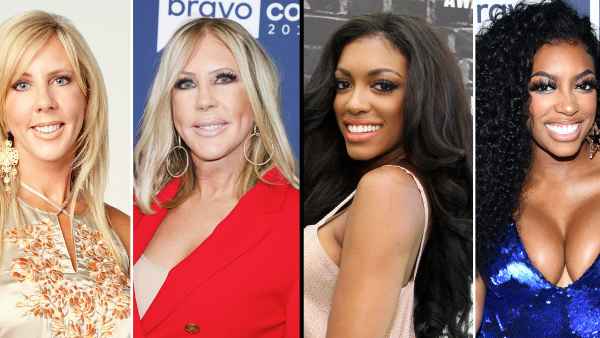 Real Housewives Plastic Surgeries Before and After