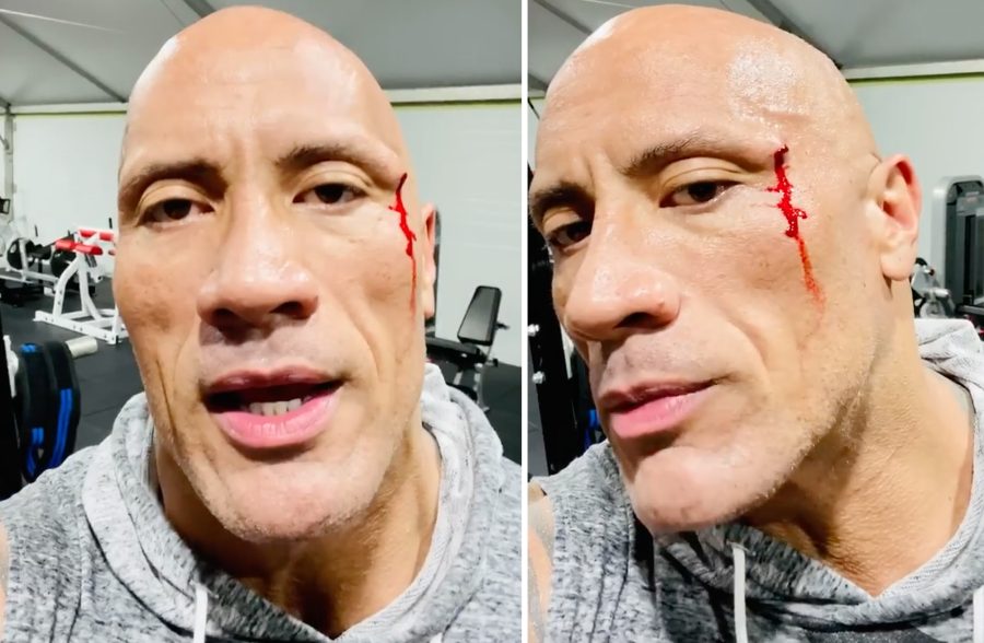 Dwayne Johnson Injury