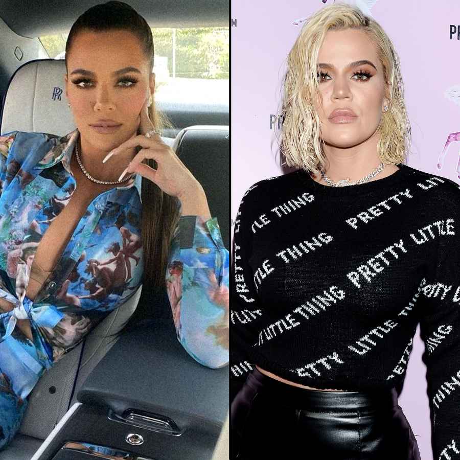 Khloe Kardashian Before and After Plastic Surgery