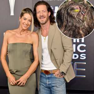 Country Singer Tyler Hubbard Wife Removes Fish Hook From His Head in Wild Camping Trip Video