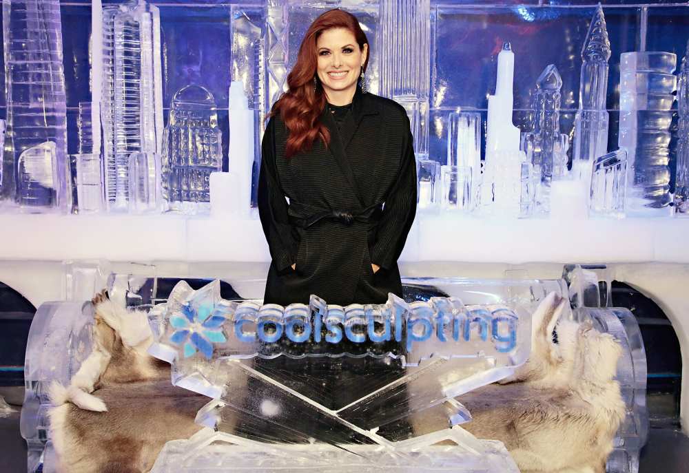 Debra Messing CoolSculpting