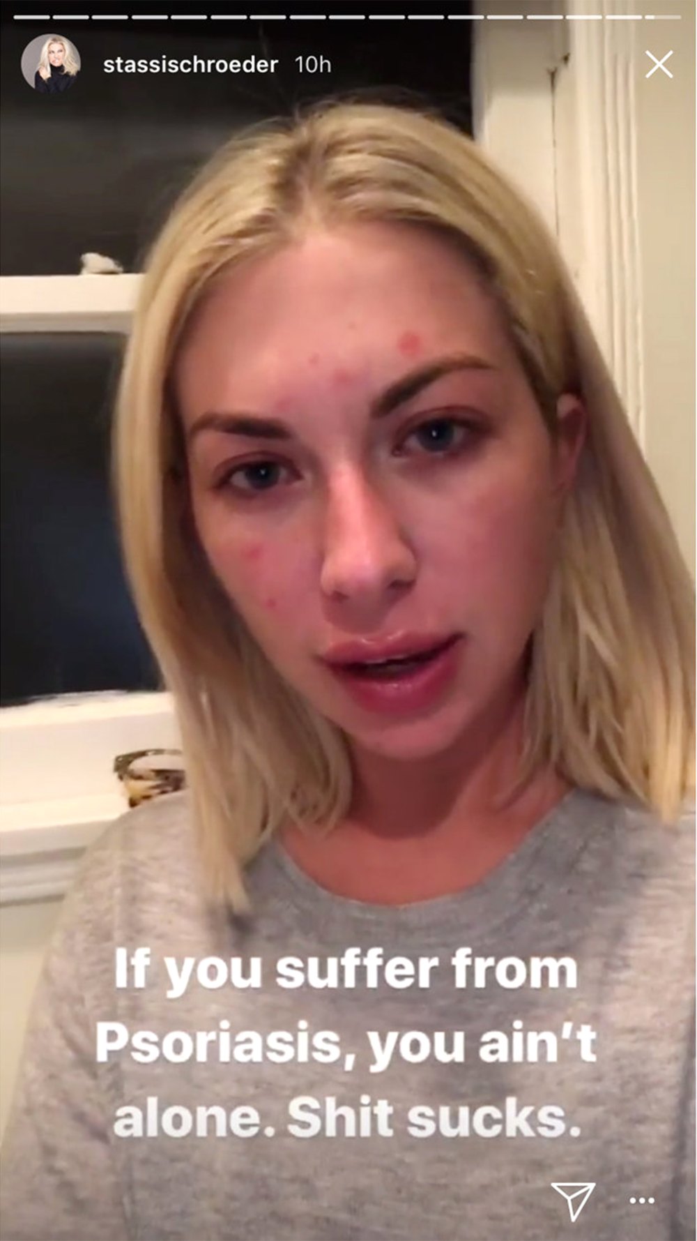 Stassi Schroeder