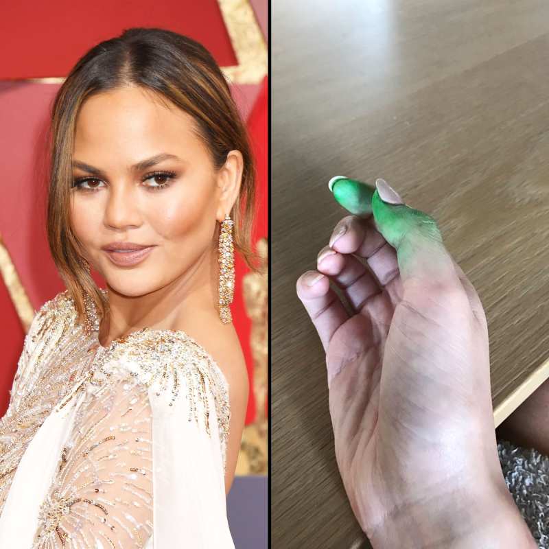 Chrissy Teigen and fun dip stained hands