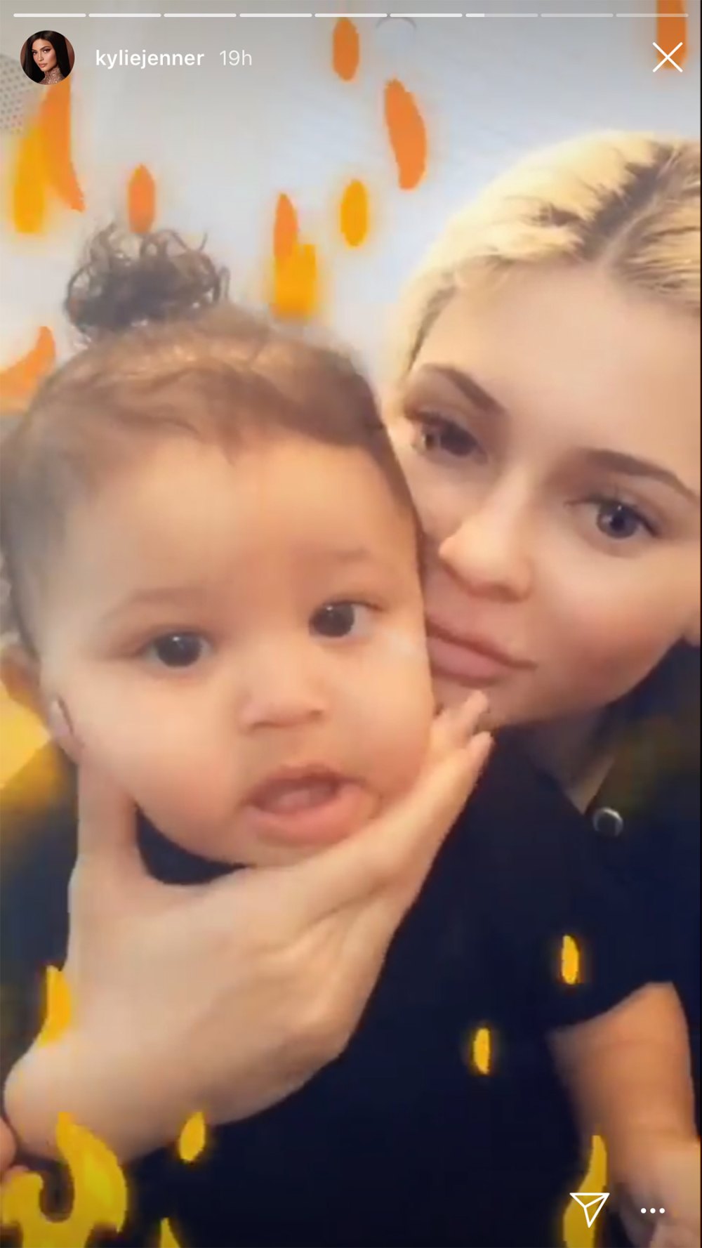 Kylie Jenner Goofs Around With Stormi Who Has New Teeth