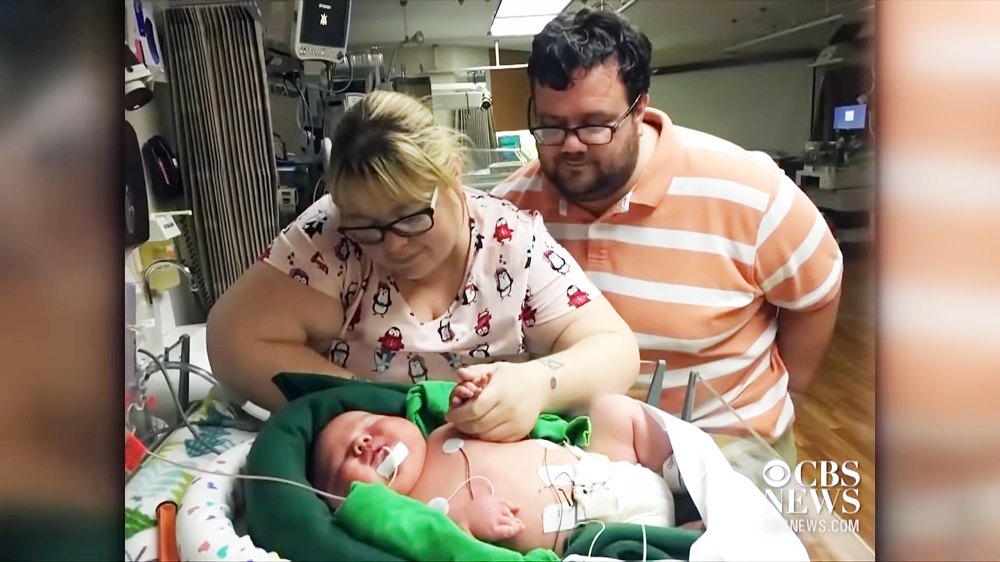 15 lb Baby Breaks Weight Record