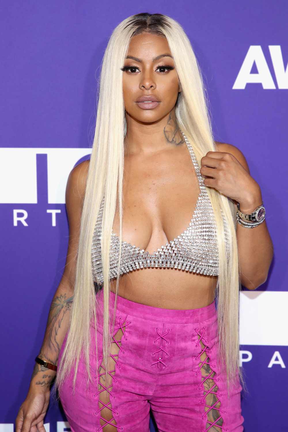 Alexis Skyy’s Baby Undergoes Surgery: ‘Prayers Please’