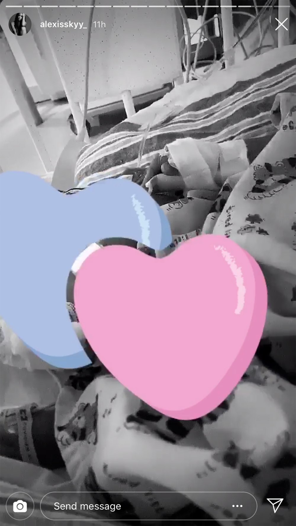Alexis Skyy’s Baby Undergoes Surgery: ‘Prayers Please’