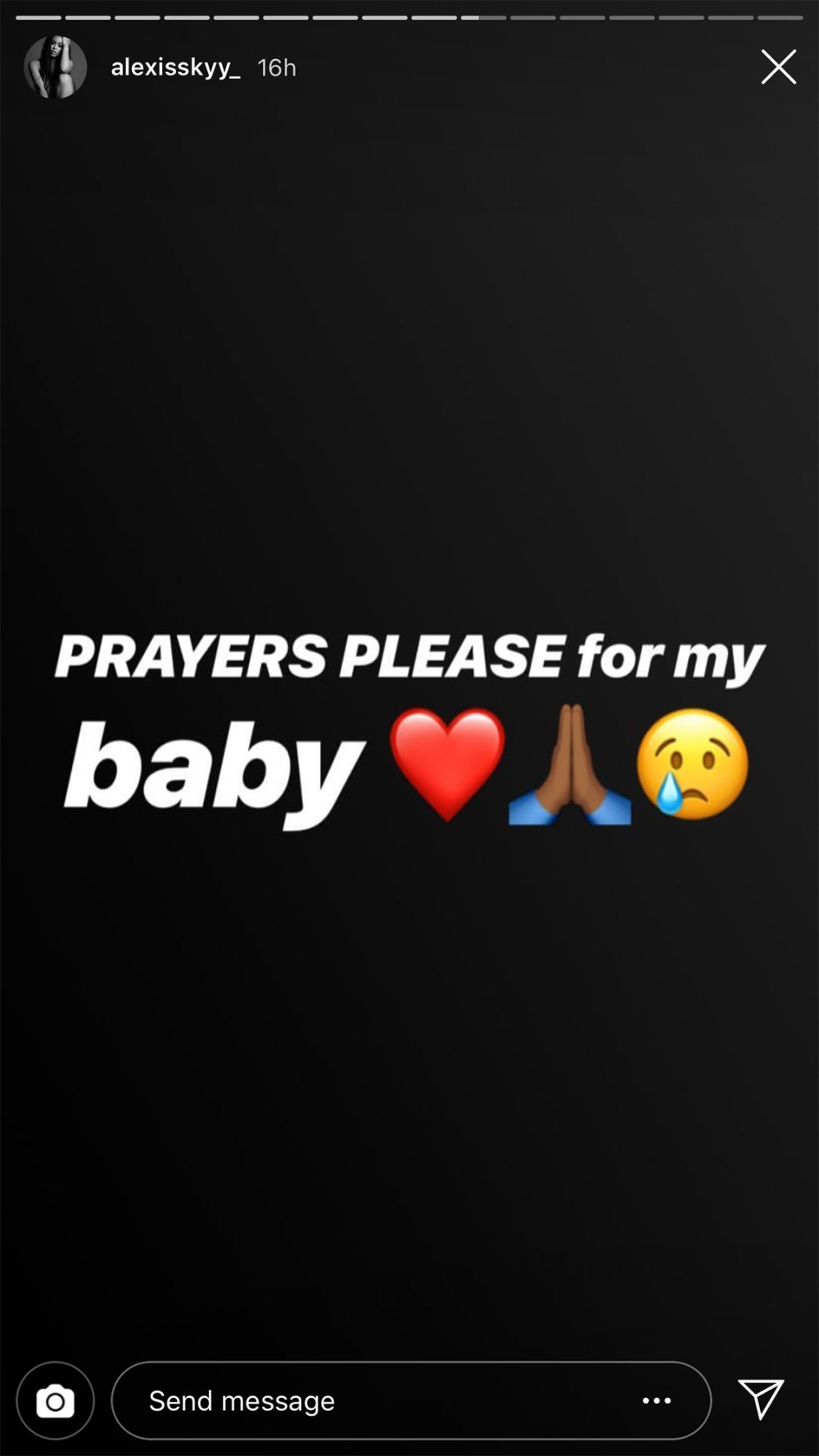 Alexis Skyy’s Baby Undergoes Surgery: ‘Prayers Please’