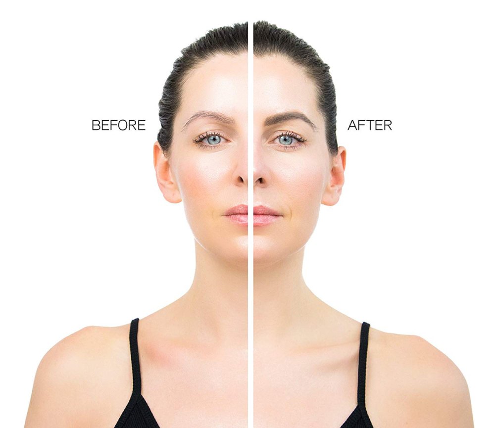 before-after