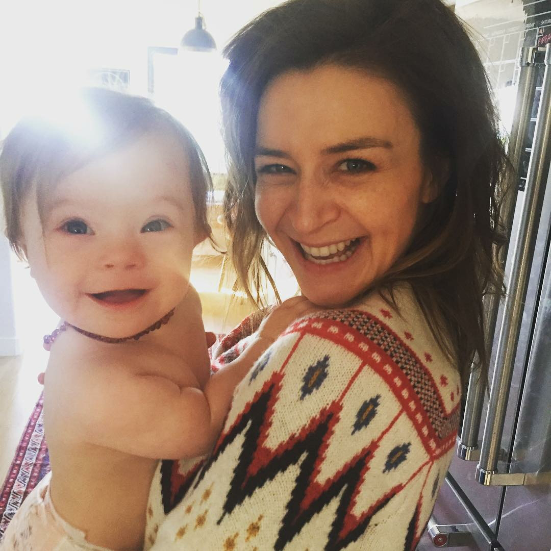 caterina scorsone's reactions to daughter's down syndrome