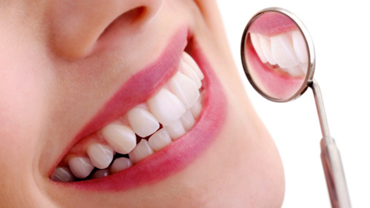 white-smile