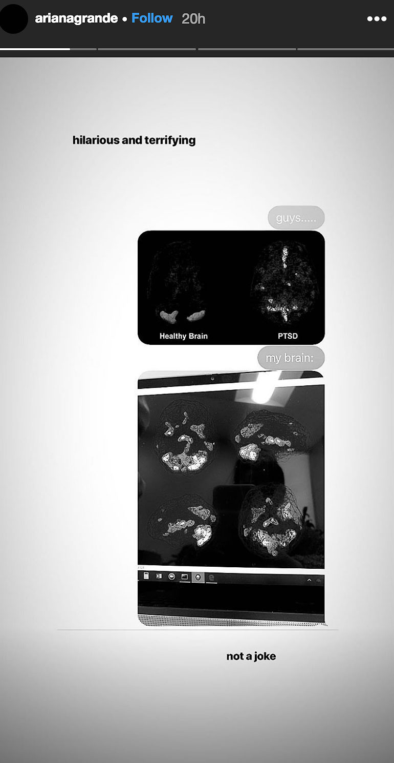 Ariana Grande Brain Scans Instagram Story