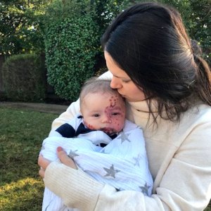 Bachelor Shawntel Newton Son Birthmark Mistakenly Deemed Measles