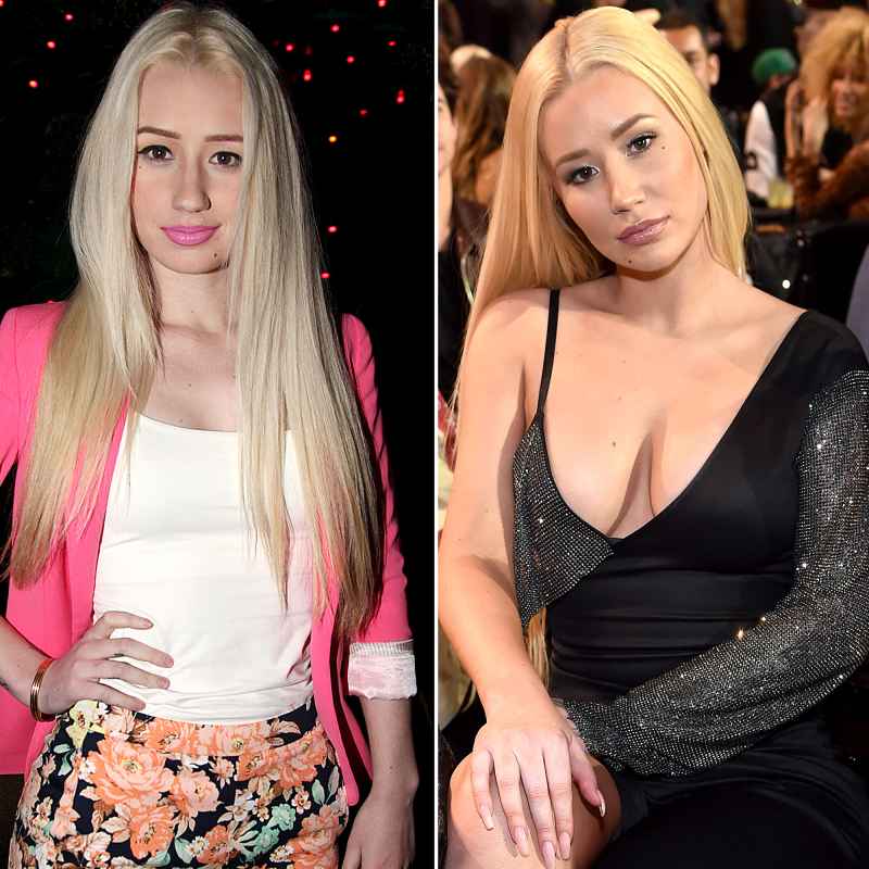 plastic surgery celebs before after