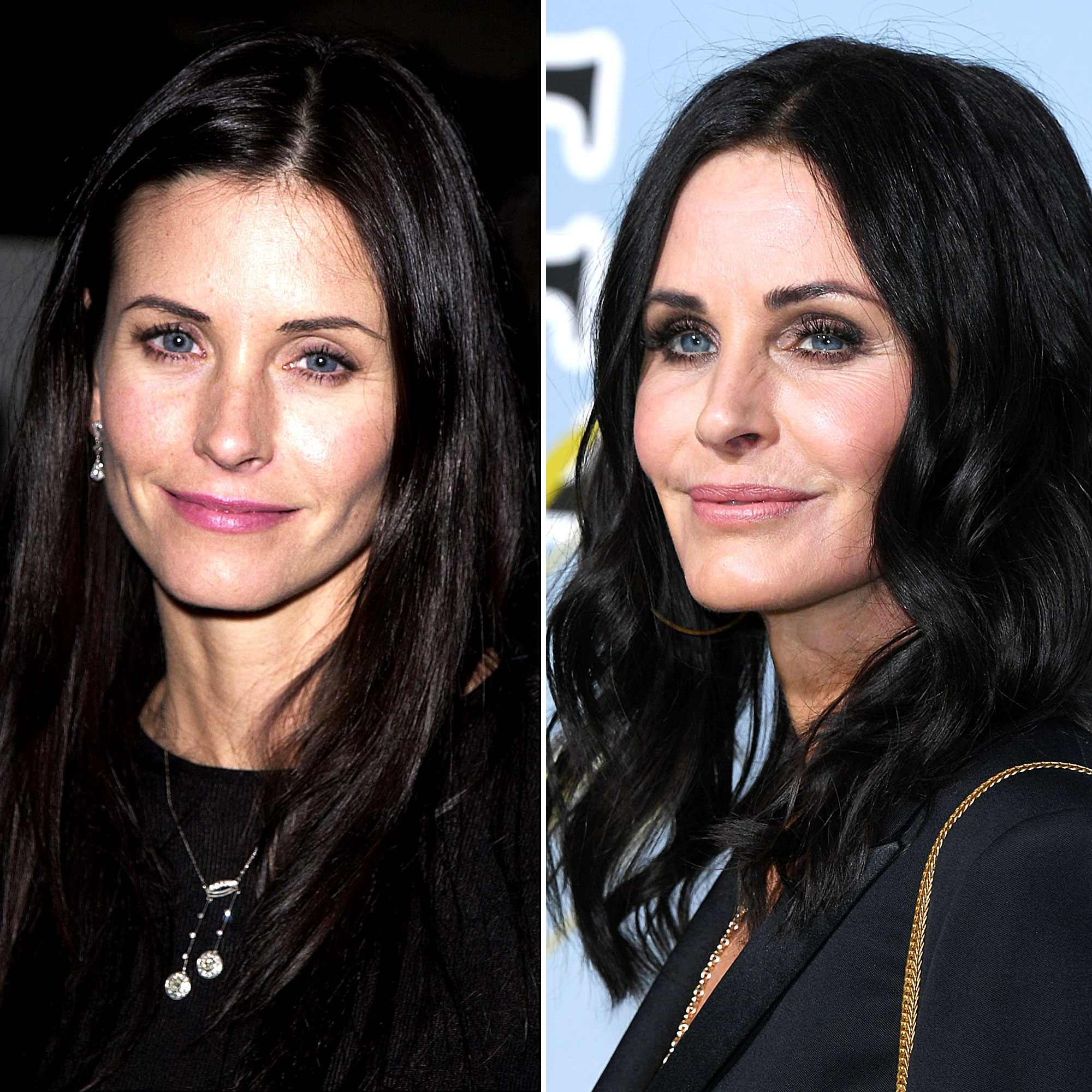 Weird Looking Celebrities After Plastic Surgery Weird Looking Celebrities After Plastic Surgery
