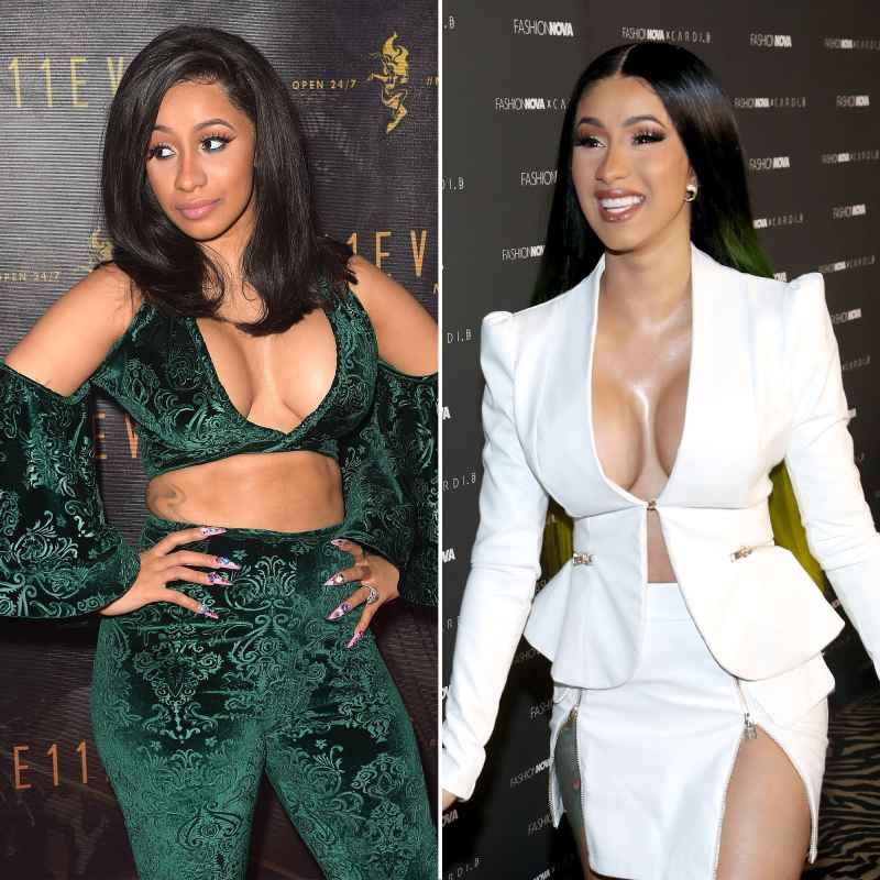 Cardi B Before and After Plastic Surgery