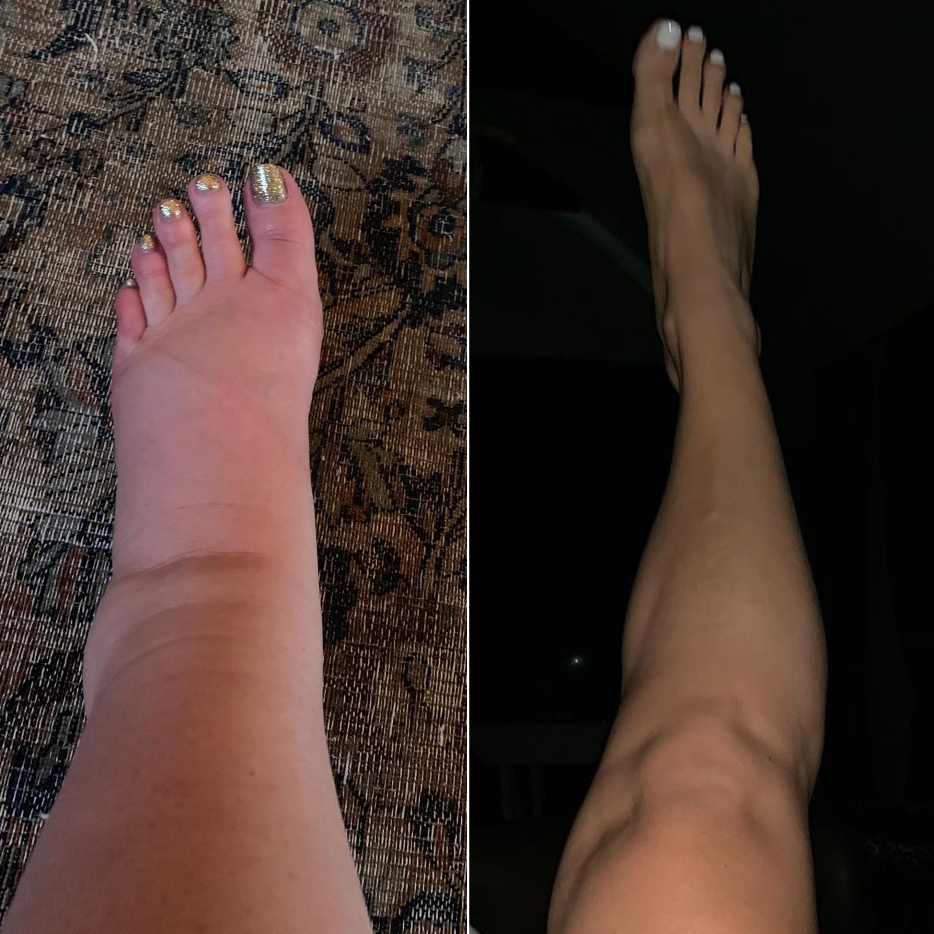 Jessica Simpson’s Postpartum Ankle Pic After Swollen Pregnancy Feet ...
