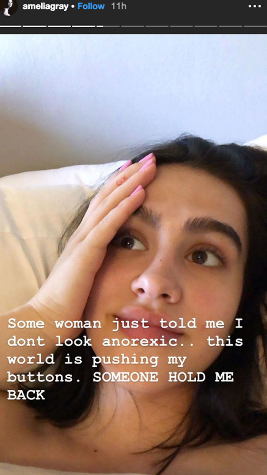 Lisa Rinna’s Daughter Amelia Hamlin Gets Real About Her Anorexia Battle-2