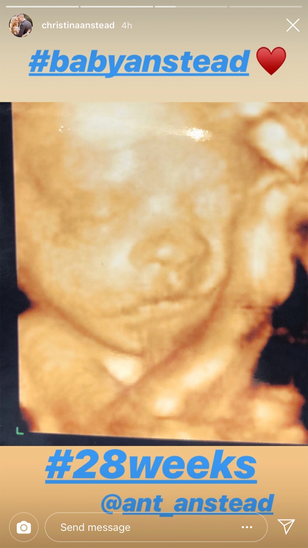 Pregnant Christina Anstead Shares Sonogram