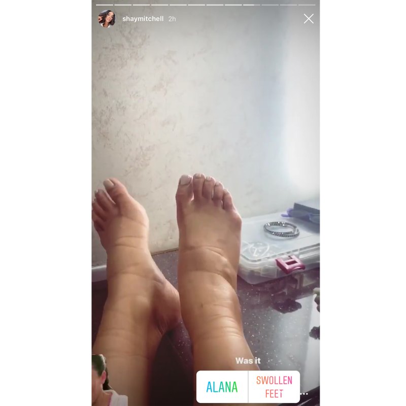 Pregnant Shay Mitchell Swollen Feet