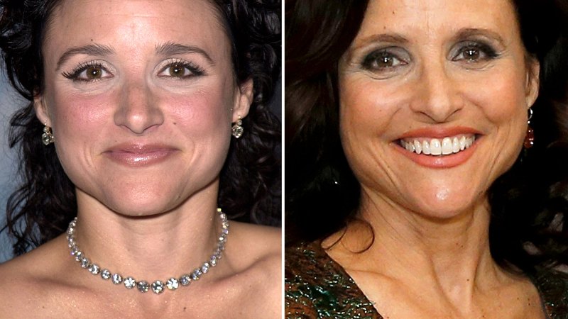 It’s safe to say that Louis-Dreyfus' career was just getting started o...