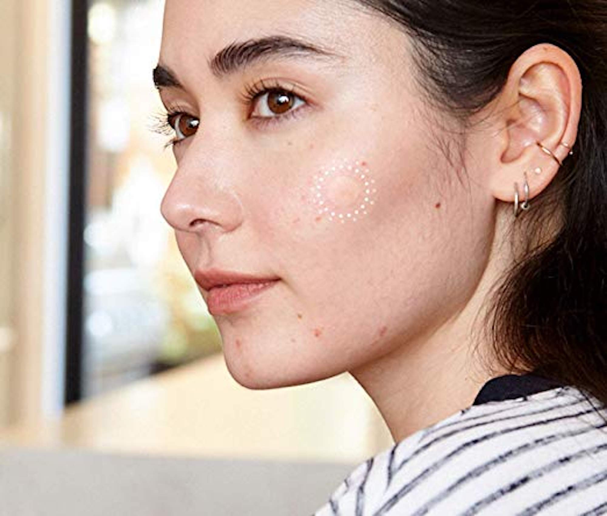 pimple patch treatment