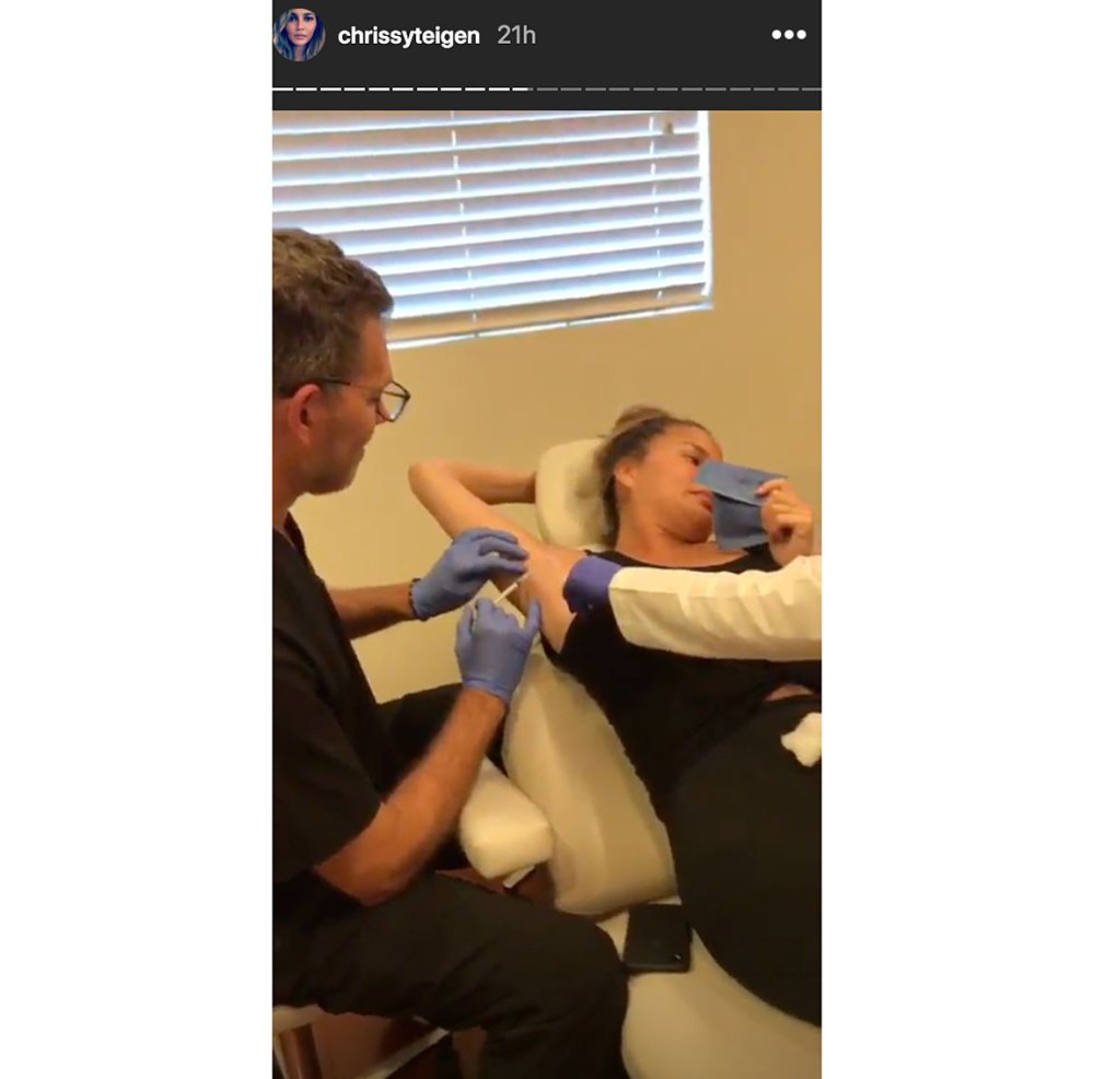 Chrissy Teigen Botoxes Armpit Instagram Story