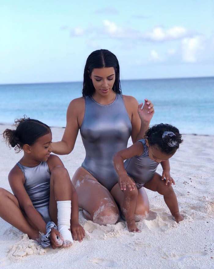 Kim-Kardashian-Reveals-Why-Daughter-North-wearing-ankle-wrap