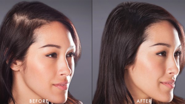 before and after