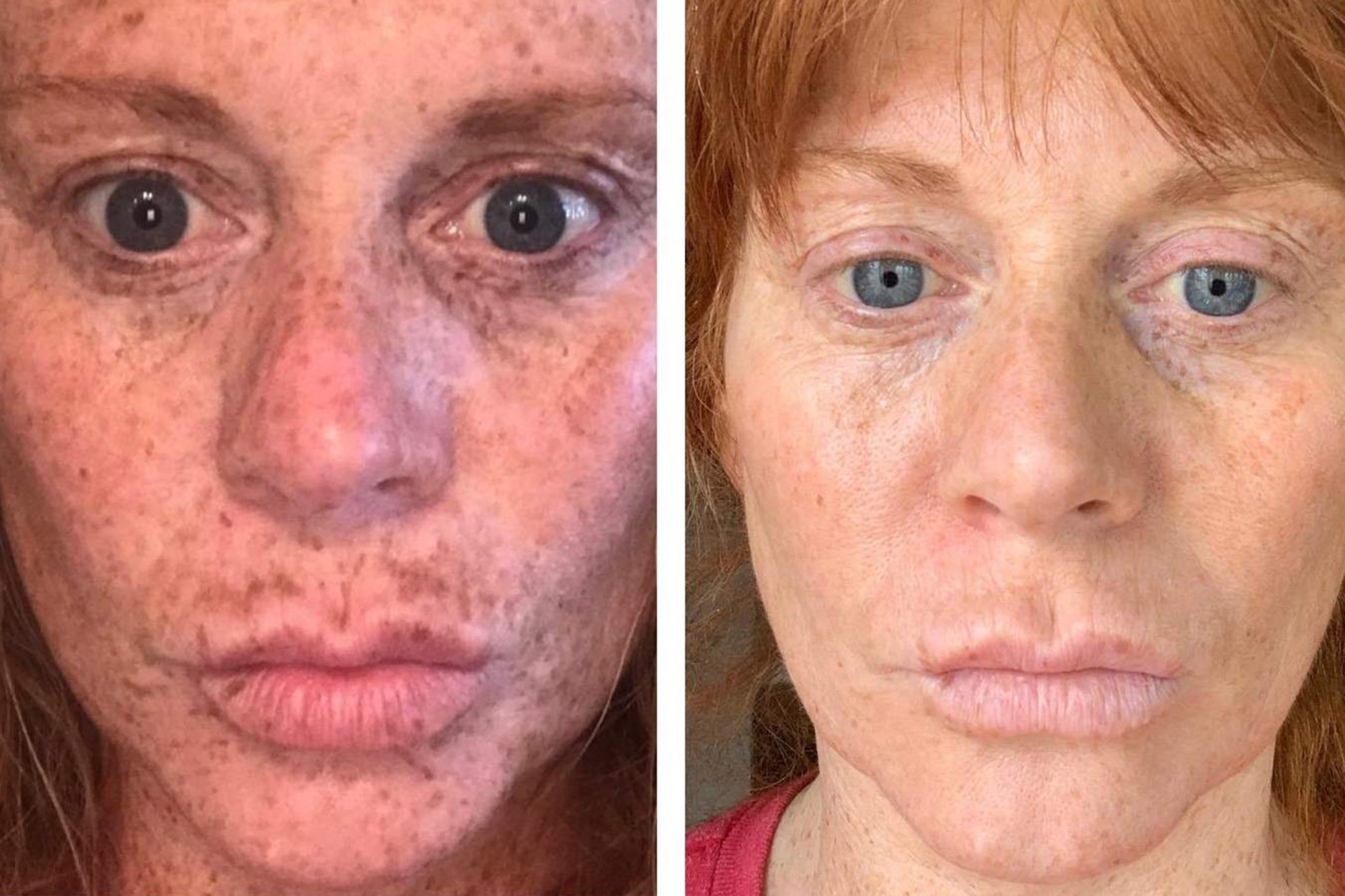 This Dark Spot Serum Has Changed the Lives of Over 4,000 Shoppers