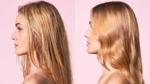 before and after