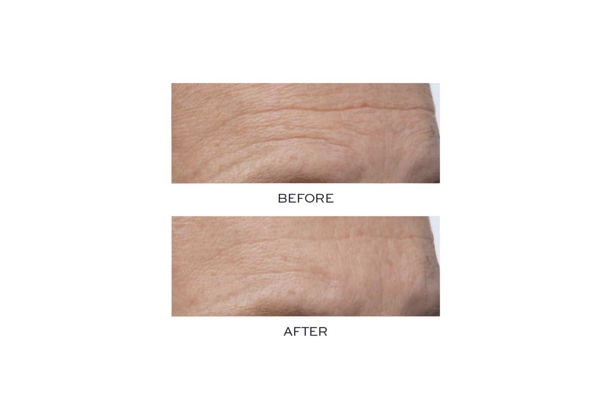 Before-and-After-Serum-Nordstrom