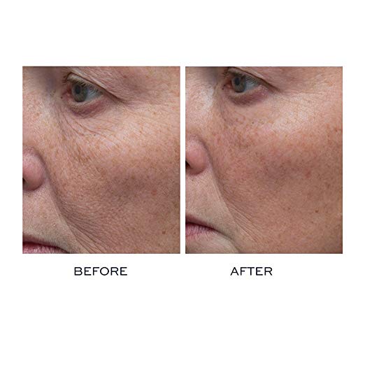 ELEMIS Peptide⁴ Thousand Flower Mask before after