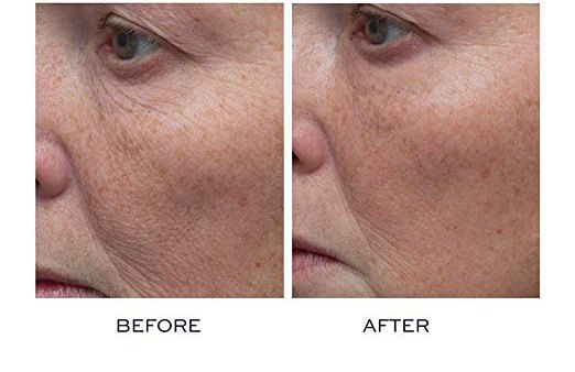 ELEMIS Peptide⁴ Thousand Flower Mask before after