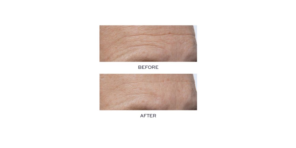 Elemis-Serum-Amazon