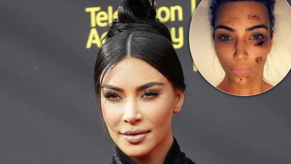 Kim Kardashian Gets Candid About Psoriasis, Diet Changes