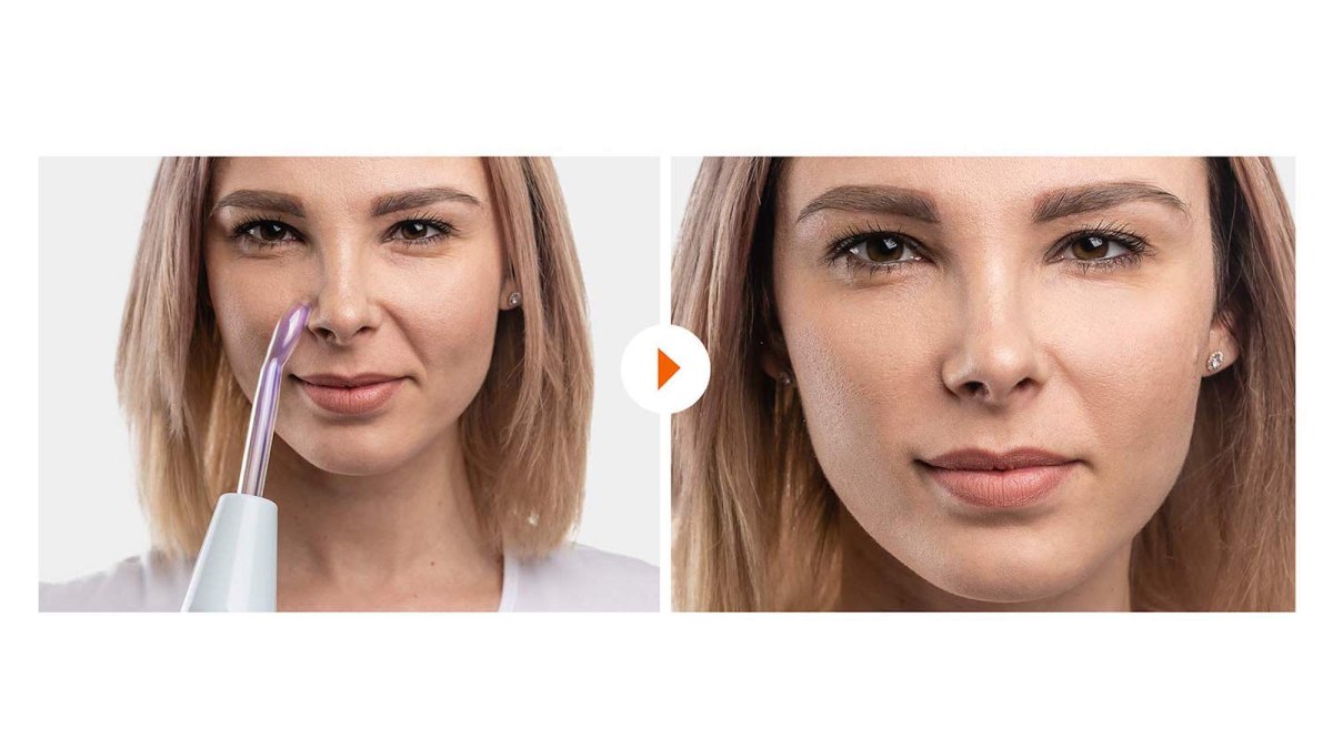 NuDerma Before & After