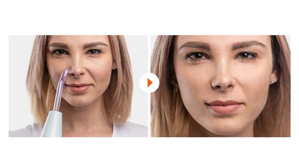 NuDerma Before & After