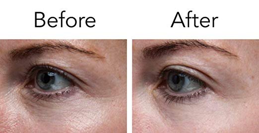 Pronexa Lavish Eyes Anti-Aging Eye Serum Before And After