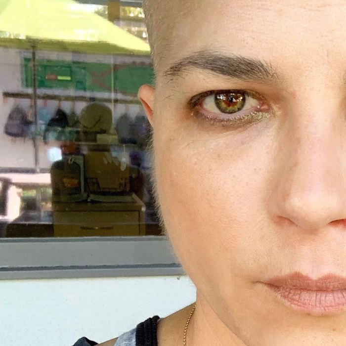 Selma Blair Says Peach Fuzz Is a ‘New Development’ on Her Face