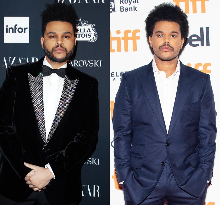 The Weeknd Before And After