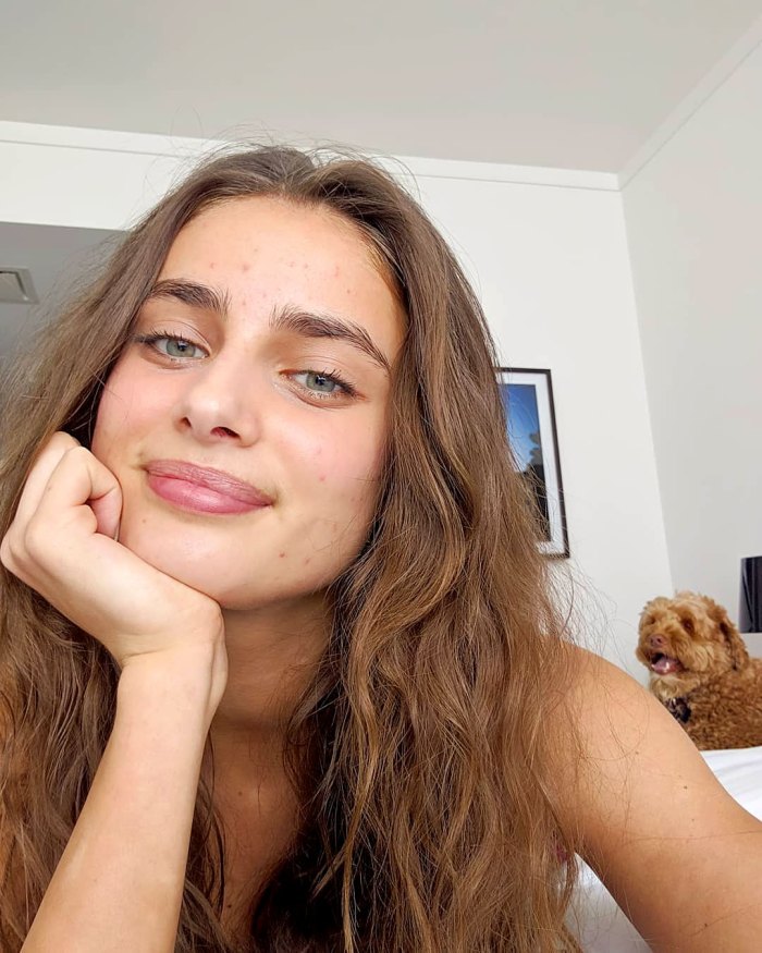 Taylor Hill Talks Struggling With Acne