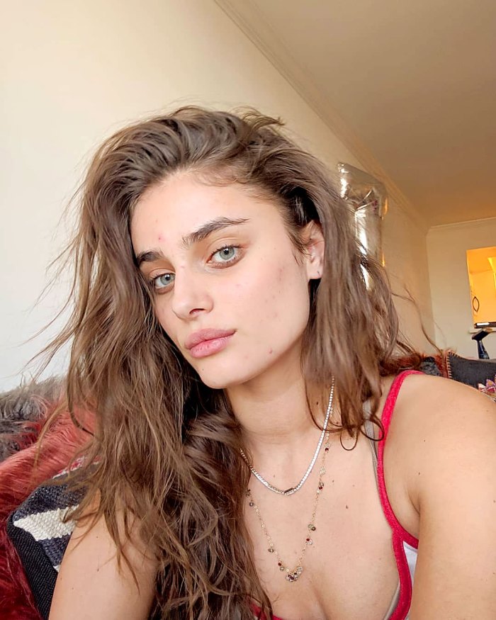 Taylor Hill Talks Struggling With Acne