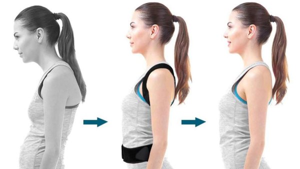 posture corrector