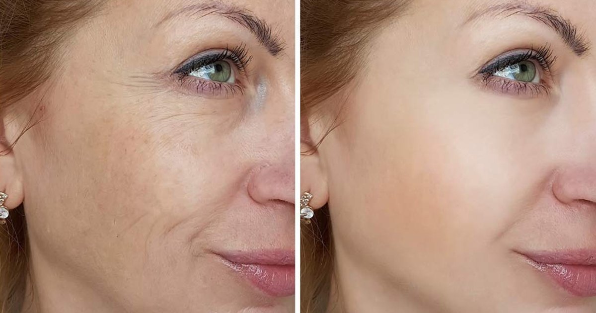 Shop This Smoothing Serum That Works Like ‘Magic’ to Erase Wrinkles Shop This Smoothing Serum That Works Like ‘Magic’ to Erase Wrinkles