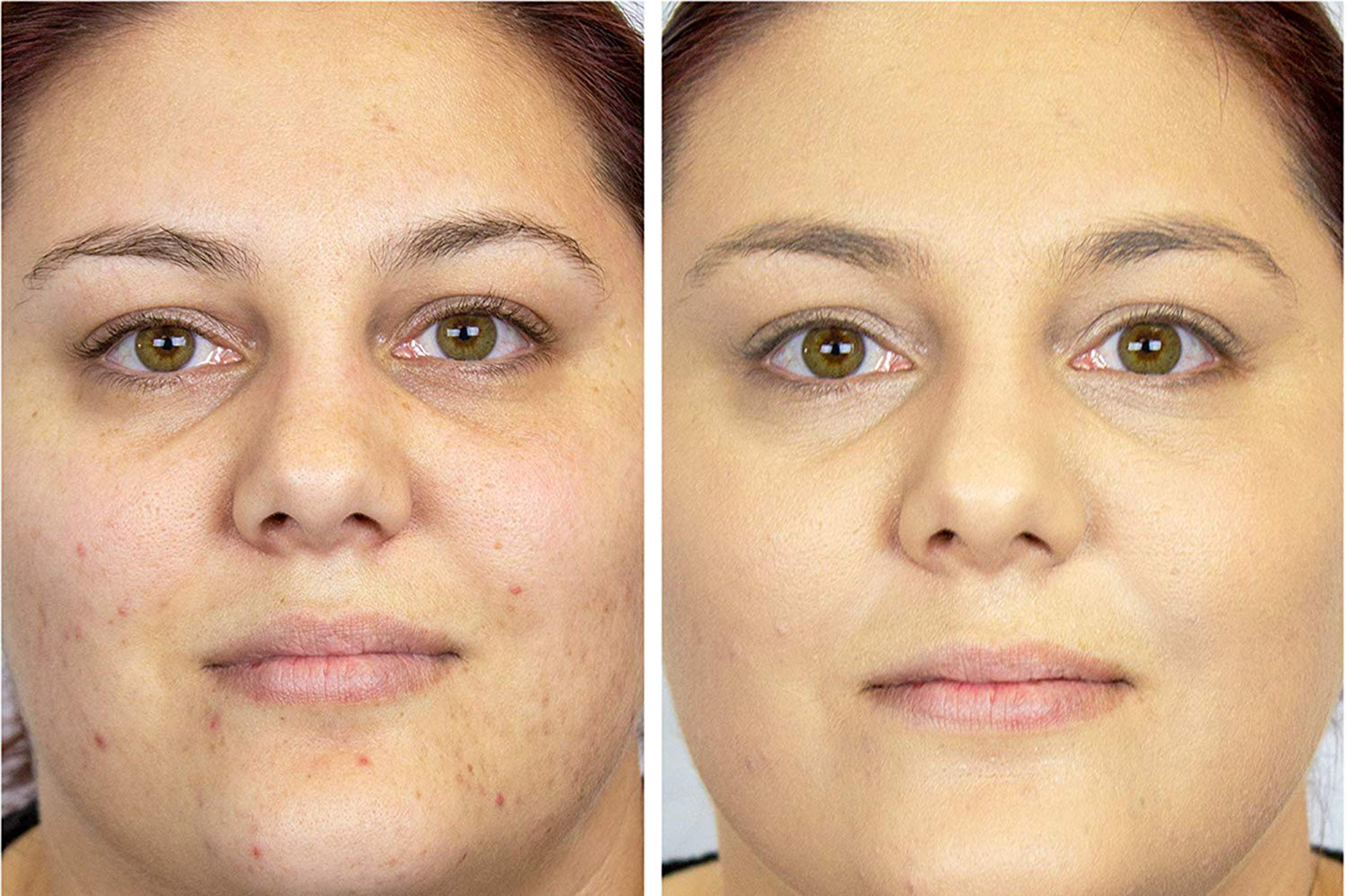 Hey Honey Trick and Treat CC² Active Moisturizing Cream before and after