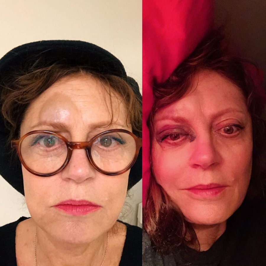 Susan Sarandon Injury Instagram